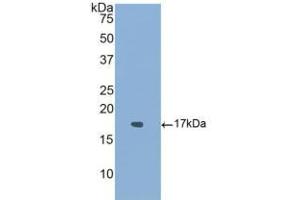 Western blot analysis of recombinant Human ACVR1. (ACVR1 antibody  (AA 208-340))