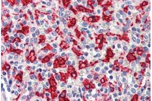 Human Spleen (formalin-fixed, paraffin-embedded) stained with HMOX1 antibody ABIN462109 at 10 ug/ml followed by biotinylated goat anti-rabbit IgG secondary antibody ABIN481713, alkaline phosphatase-streptavidin and chromogen. (HMOX1 antibody)