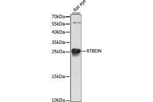 Western blot analysis of extracts of Rat eye using RTBDN Polyclonal Antibody at dilution of 1:1000. (Retbindin antibody)