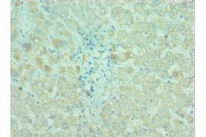 Immunohistochemistry of paraffin-embedded human liver tissue using ABIN7145198 at dilution of 1:100 (BIRC2 antibody  (AA 1-300))