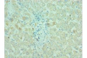 Immunohistochemistry of paraffin-embedded human liver tissue using ABIN7145198 at dilution of 1:100 (BIRC2 antibody  (AA 1-300))