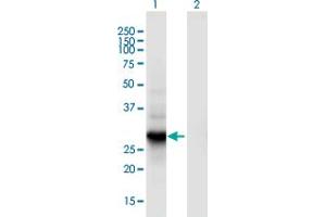 Western Blot analysis of RGS18 expression in transfected 293T cell line by RGS18 monoclonal antibody (M02), clone 1G12. (RGS18 antibody  (AA 1-235))