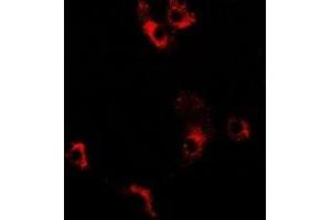 Immunofluorescent analysis of Decorin staining in MCF7 cells. (Decorin antibody)