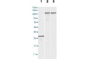Western blot analysis using DNM2 monoclonal antibody, clone 5E4C2F3  against truncated DNM2 recombinant protein (Lane 1), SK-N-SH (Lane 2) and NIH/3T3 (Lane 3) cell lysates. (DNM2 antibody)