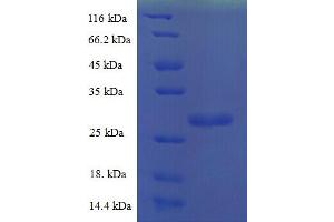 SDS-PAGE (SDS) image for Fibroblast Growth Factor 1 (Acidic) (FGF1) (AA 16-155) protein (His-SUMO Tag) (ABIN5709515)