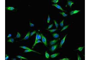 Immunofluorescent analysis of Hela cells using ABIN7159758 at dilution of 1:100 and Alexa Fluor 488-congugated AffiniPure Goat Anti-Rabbit IgG(H+L) (MAP4 antibody  (AA 575-818))