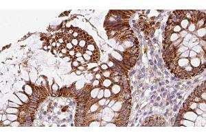 ABIN6272858 at 1/100 staining Mouse colon tissue by IHC-P. (IFT20 antibody)