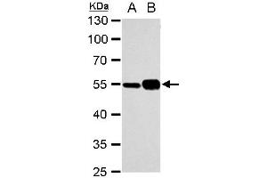 WB Image alpha Tubulin 1A antibody detects alpha Tubulin 1A protein by western blot analysis.