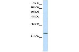 WB Suggested Anti-MXD3 Antibody Titration: 0. (MXD3 antibody  (N-Term))