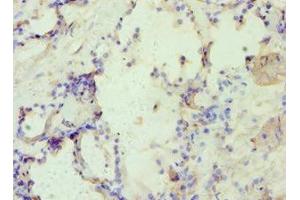 Immunohistochemistry of paraffin-embedded human prostate tissue using ABIN7144361 at dilution of 1:100 (alpha Adaptin antibody  (AA 1-260))