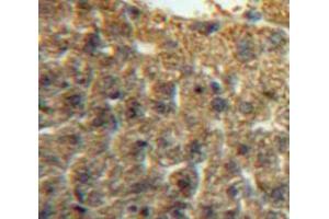 Used in DAB staining on fromalin fixed paraffin-embedded Liver tissue (IRF5 antibody  (AA 3-250))