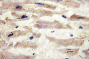 Immunohistochemistry (IHC) analyzes of Laminin alpha-4 antibody in paraffin-embedded human heart tissue. (LAMa4 antibody)