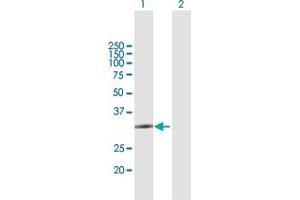 Western Blot analysis of ZCCHC9 expression in transfected 293T cell line by ZCCHC9 MaxPab polyclonal antibody. (ZCCHC9 antibody  (AA 1-271))