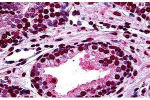 Human Prostate: Formalin-Fixed, Paraffin-Embedded (FFPE) (DLX2 antibody  (AA 1-110))