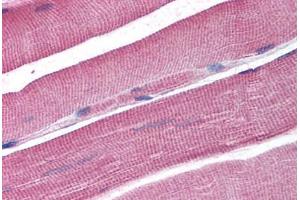 Human Skeletal Muscle (formalin-fixed, paraffin-embedded) stained with DCLRE1A antibody ABIN298128 at 2. (SNM1 antibody  (AA 397-410))