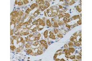ASAH2 antibody