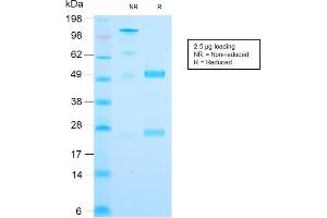 SDS-PAGE Analysis Purified Cytochrome C Recombinant Rabbit Monoclonal (CYCS/3128R). (Recombinant Cytochrome C antibody)