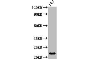 Western Blot Positive WB detected in: U87 whole cell lysate All lanes: AK1 antibody at 2. (Adenylate Kinase 1 antibody  (AA 1-194))