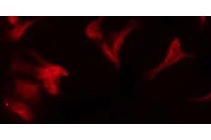 anti-Cytochrome P450 11B1/2 antibody