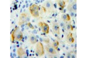 IHC-P analysis of Liver tissue, with DAB staining. (CD1d antibody  (AA 56-271))