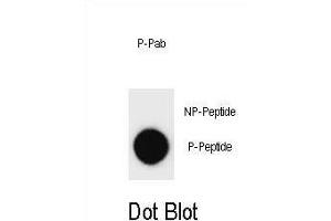 Dot blot analysis of Phospho-ERBB2- Antibody Phospho-specific Pab m on nitrocellulose membrane. (ErbB2/Her2 antibody  (pTyr877))