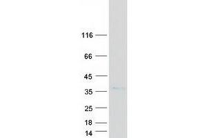 Four and A Half LIM Domains 1 (FHL1) (Transcript Variant 4) protein (Myc-DYKDDDDK Tag)