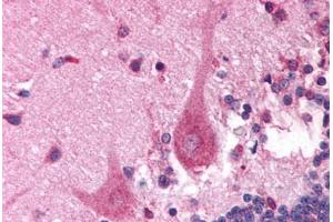 Human Brain, Cerebellum (formalin-fixed, paraffin-embedded) stained with PITX3 antibody ABIN214803 at 5 ug/ml followed by biotinylated goat anti-rabbit IgG secondary antibody ABIN481713, alkaline phosphatase-streptavidin and chromogen. (PITX3 antibody  (N-Term))