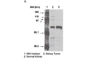 Western blot using CYP4F11 antibody one normal (2) and cancerous (3) kidney cell lysates. (CYP4F11 antibody  (C-Term))