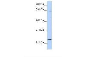 Image no. 1 for anti-ChaC, Cation Transport Regulator Homolog 1 (CHAC1) (AA 188-237) antibody (ABIN6738039) (CHAC1 antibody  (AA 188-237))