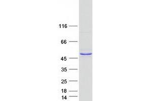 Western Blotting (WB) image for Endonuclease 8-like 2 (NEIL2) (Transcript Variant 2) protein (Myc-DYKDDDDK Tag) (ABIN2727072)