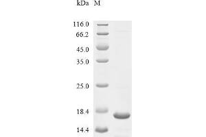 (Tris-Glycine gel) Discontinuous SDS-PAGE (reduced) with 5 % enrichment gel and 15 % separation gel.