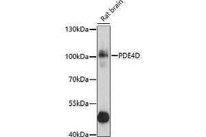 Western blot analysis of extracts of rat brain, using PDE4D antibody (ABIN3022336, ABIN3022337, ABIN3022338 and ABIN6218749) at 1:1000 dilution. (PDE4D antibody  (AA 249-518))