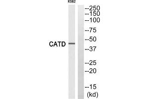 Western blot analysis of extracts from K562 cells, using CATD (light chain, Cleaved-Gln161) antibody. (Cathepsin D antibody  (Cleaved-Gln161))