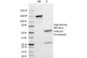 SDS-PAGE Analysis Purified Lambda Light Chain Mouse Monoclonal Antibody (HP6054). (IgL antibody)