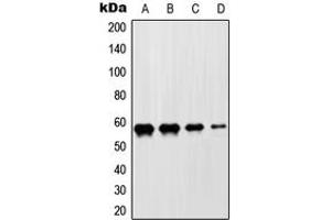 Western blot analysis of ZNF682 expression in HeLa (A), Jurkat (B), NIH3T3 (C), H9C2 (D) whole cell lysates.