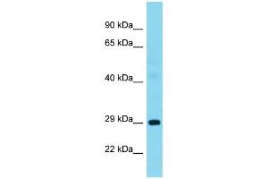 Host:  Rabbit  Target Name:  G3BP1  Sample Type:  Pancreas tumor lysates  Antibody Dilution:  1. (G3BP1 antibody  (N-Term))