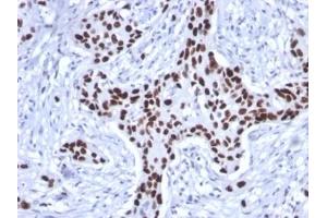 ABIN6383817 to TP53 was successfully used to stain human breast carcinoma sections. (Recombinant p53 antibody)