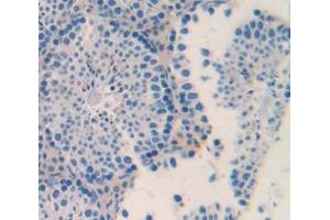 IHC-P analysis of Mouse Tissue, with DAB staining. (ACVR2A antibody  (AA 326-485))