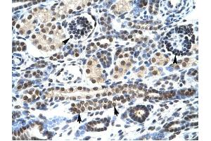 HTR3A antibody was used for immunohistochemistry at a concentration of 4-8 ug/ml to stain Epithelial cells of renal tubule (lndicated with Arrows] and renal corpuscle (Indicated with Arrow Heads) in Human Kidney.
