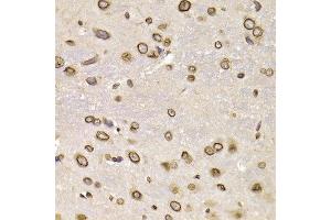 Immunohistochemistry of paraffin-embedded rat brain using LMNB2 antibody at dilution of 1:200 (400x lens). (Lamin B2 antibody)