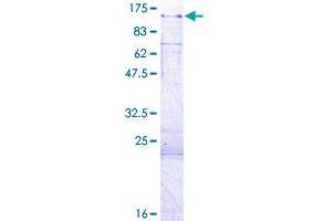 KSR2 Protein (AA 1-829) (GST tag)
