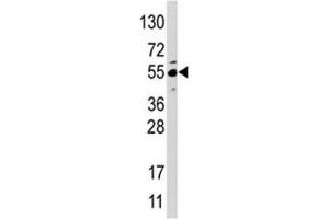 Western blot analysis of JMJD4 antibody and HepG2 lysate (JMJD4 antibody  (AA 1-30))