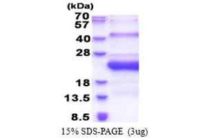 SDS-PAGE (SDS) image for Sperm Mitochondria Associated Cysteine Rich Protein (SMCP) (AA 1-116) protein (His tag) (ABIN5778858) (SMCP Protein (AA 1-116) (His tag))