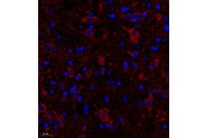 Immunofluorescence of paraffin embedded mouse spinal cord using FGF11 (ABIN7073941) at dilution of 1:2200 (400x lens) (FGF11 antibody)