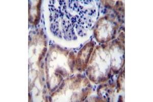 Immunohistochemistry analysis in formalin fixed and paraffin embedded human kidney tissue reacted with HYAL2 / Hyaluronidase-2 Antibody (Center) followed by peroxidase conjugation of the secondary antibody and DAB staining. (HYAL2 antibody  (Middle Region))
