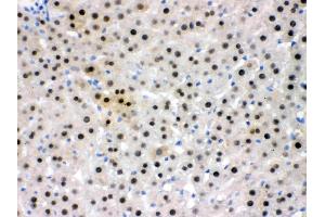 IHC analysis of NFIA using anti- NFIA antibody . (NFIA antibody  (Middle Region))