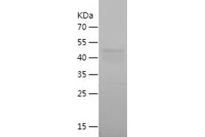 Western Blotting (WB) image for R-Spondin 3 (RSPO3) (AA 24-272) protein (His-IF2DI Tag) (ABIN7124730)