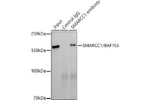 Immunoprecipitation analysis of 300 μg extracts of HepG2 cells using 3 μg SM/B antibody .