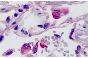 Human Lung: Formalin-Fixed, Paraffin-Embedded (FFPE) (Neurotrypsin antibody  (N-Term))