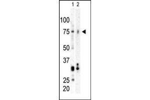 Western blot analysis of anti-CNK Pab (ABIN392602 and ABIN2842130) in SK-BR3 cell lysate (Lane A) and mouse heart tissue lysate (Lane B).